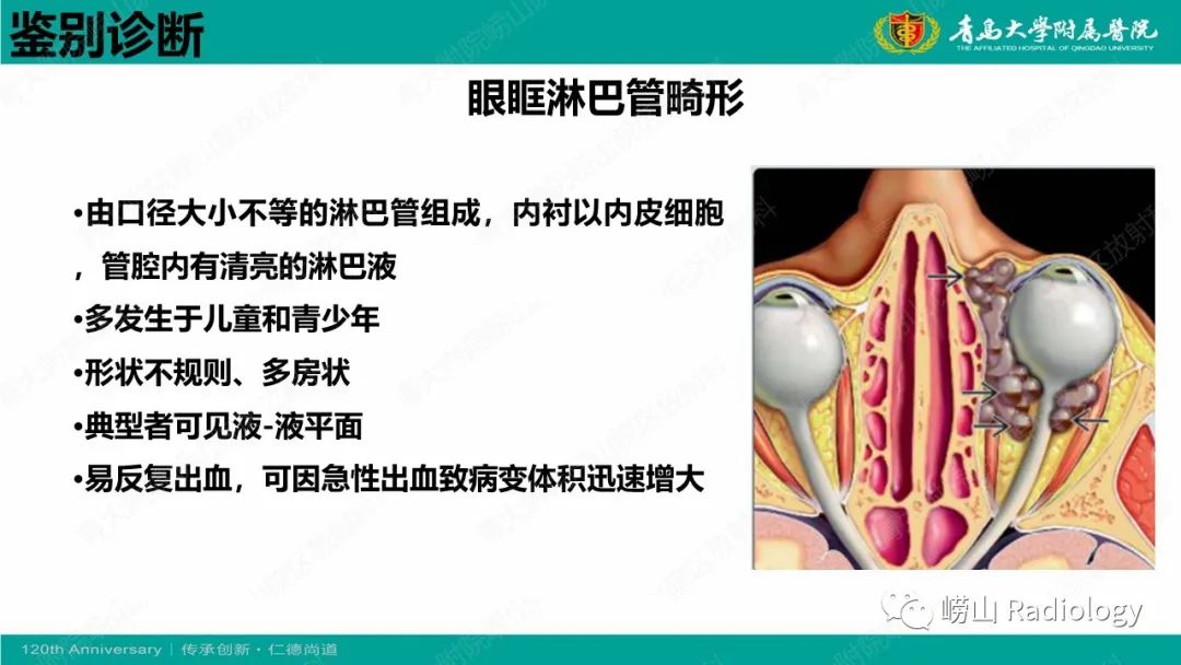 影像PPT - 【PPT】眼眶静脉曲张-16
