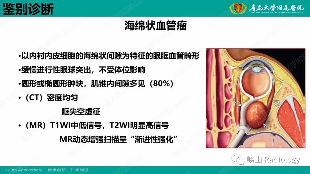 影像PPT - 【PPT】眼眶静脉曲张-19