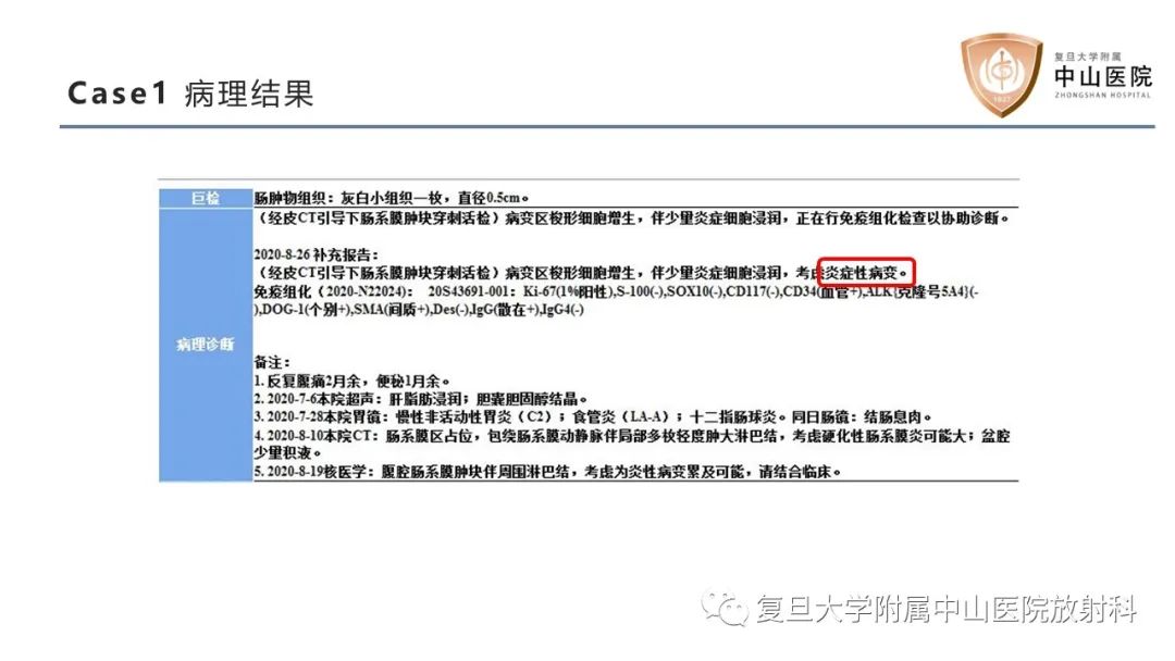影像PPT - 【病例】肠系膜孤立性肿块3例CT影像鉴别分析-11