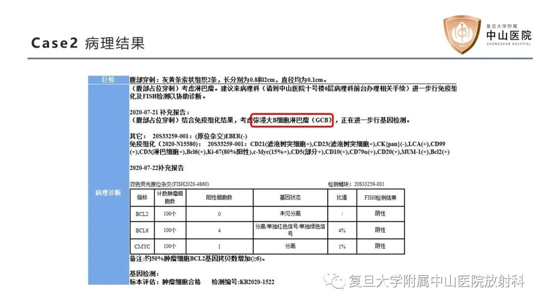 影像PPT - 【病例】肠系膜孤立性肿块3例CT影像鉴别分析-12