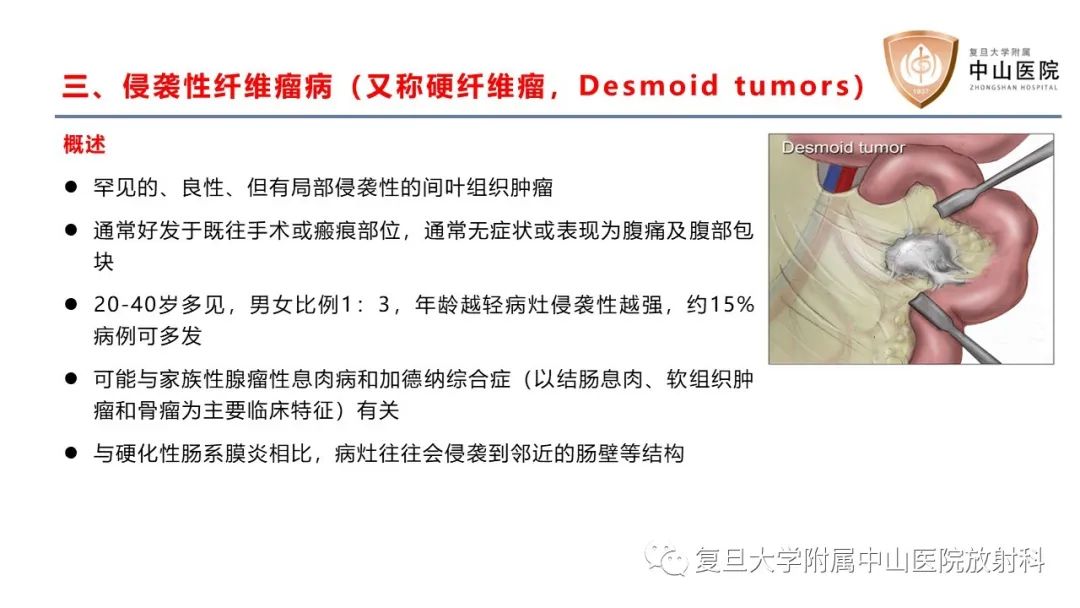 影像PPT - 【病例】肠系膜孤立性肿块3例CT影像鉴别分析-21
