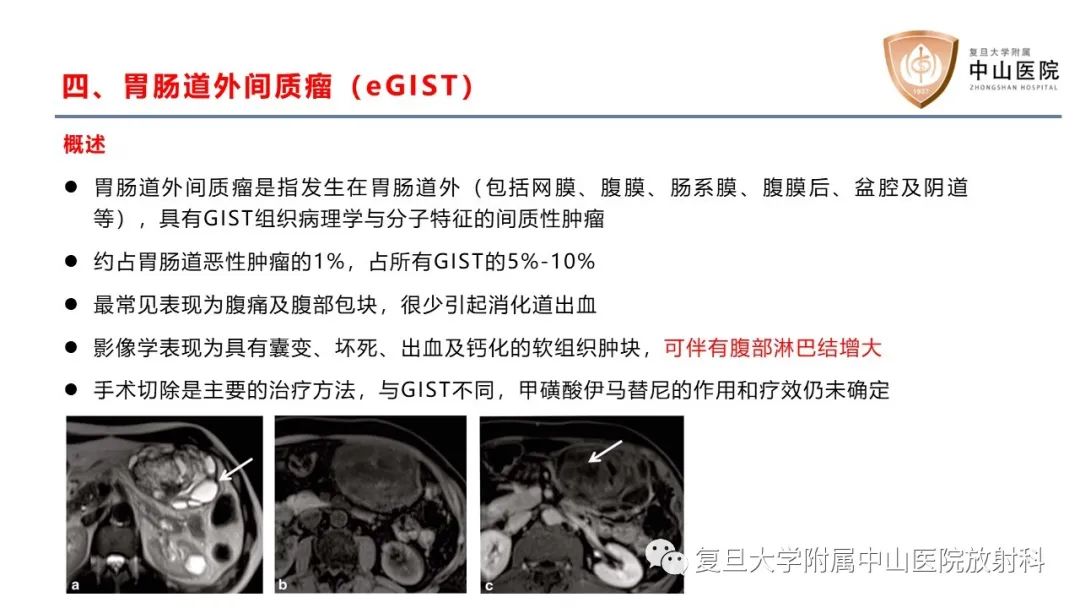 影像PPT - 【病例】肠系膜孤立性肿块3例CT影像鉴别分析-23
