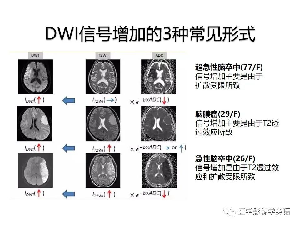 影像PPT - 【PPT】颅内DWI高信号病变：从发现病灶到准确诊断-5