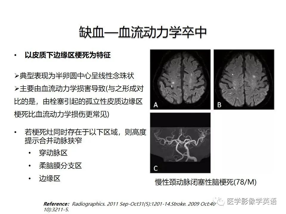 影像PPT - 【PPT】颅内DWI高信号病变：从发现病灶到准确诊断-9