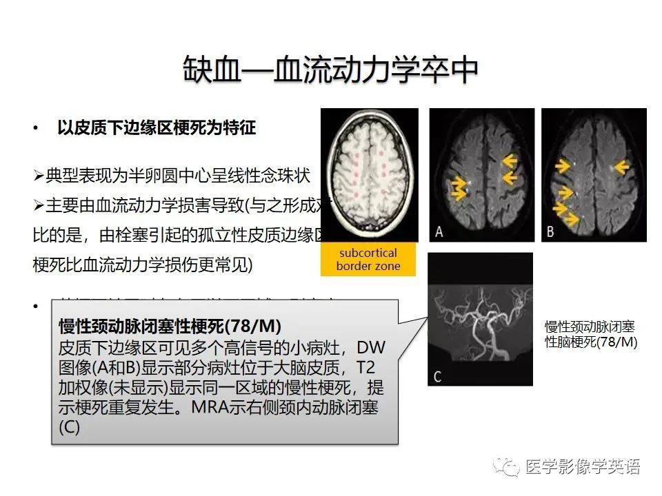 影像PPT - 【PPT】颅内DWI高信号病变：从发现病灶到准确诊断-10