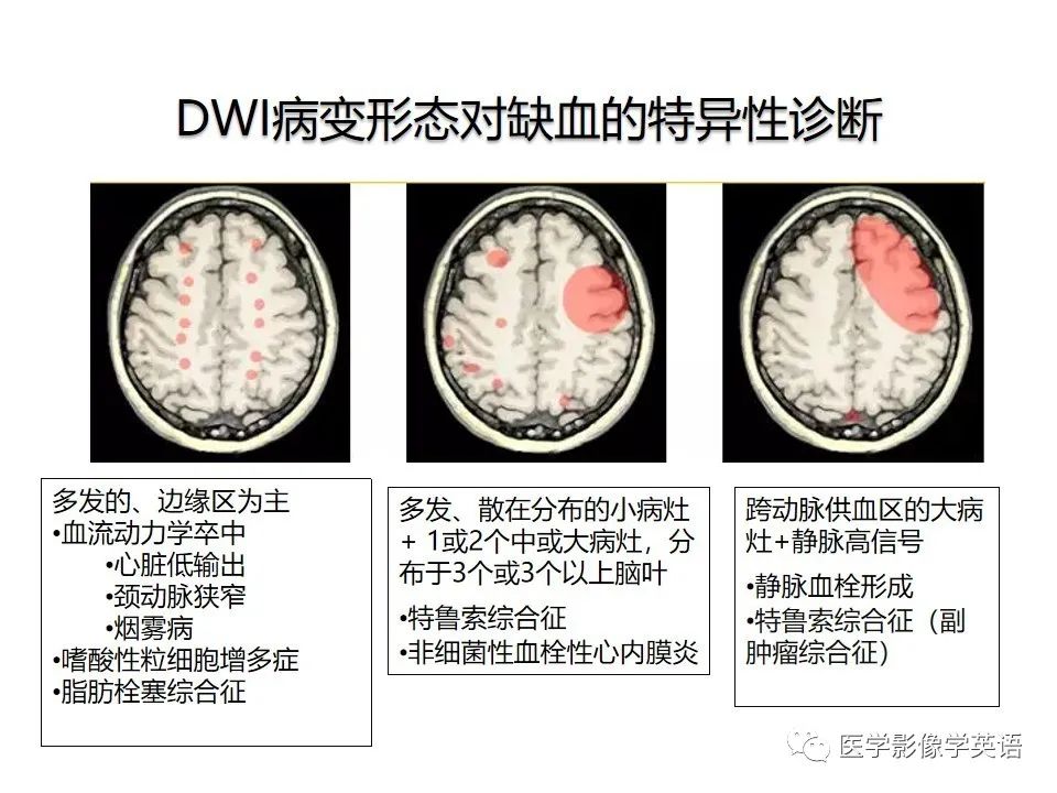 影像PPT - 【PPT】颅内DWI高信号病变：从发现病灶到准确诊断-8