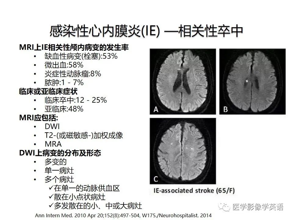 影像PPT - 【PPT】颅内DWI高信号病变：从发现病灶到准确诊断-11