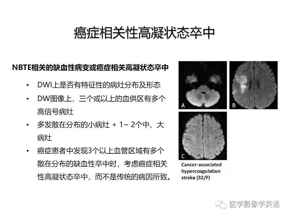 影像PPT - 【PPT】颅内DWI高信号病变：从发现病灶到准确诊断-14