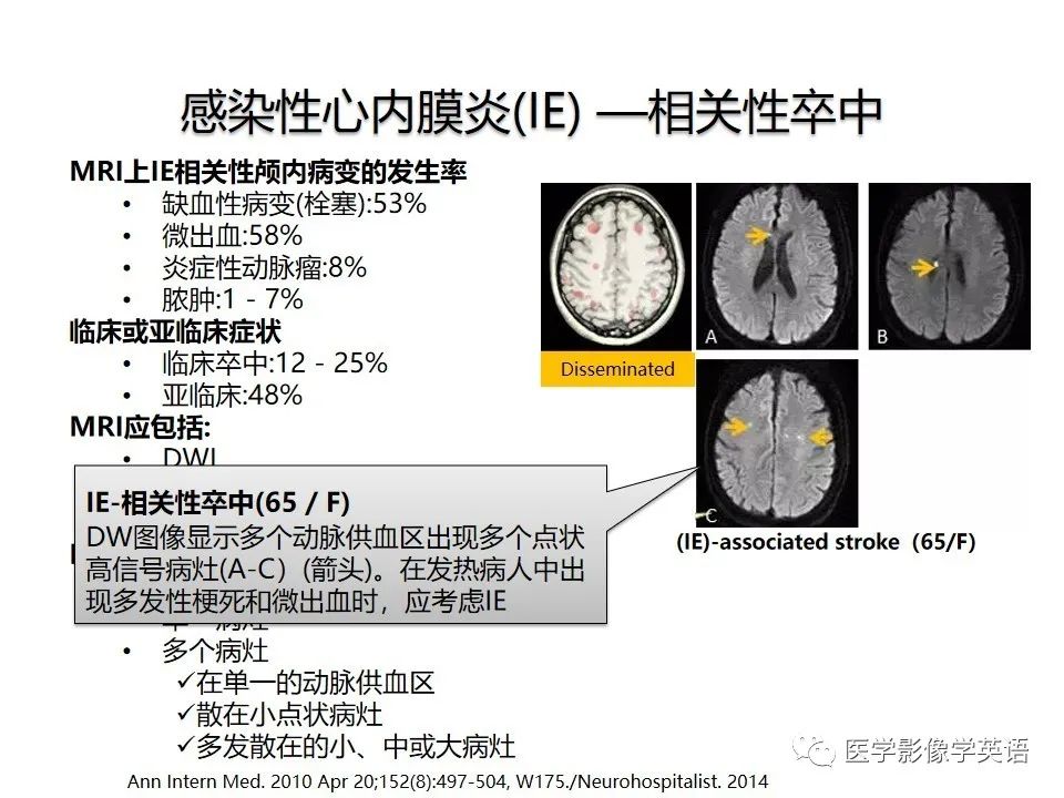 影像PPT - 【PPT】颅内DWI高信号病变：从发现病灶到准确诊断-12