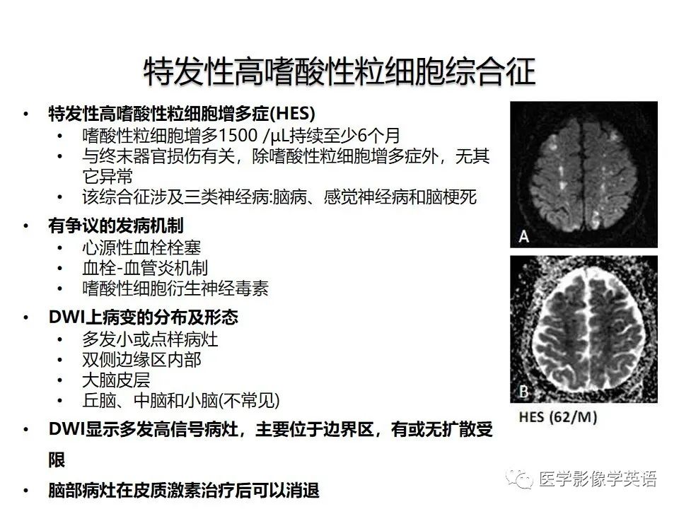 影像PPT - 【PPT】颅内DWI高信号病变：从发现病灶到准确诊断-18