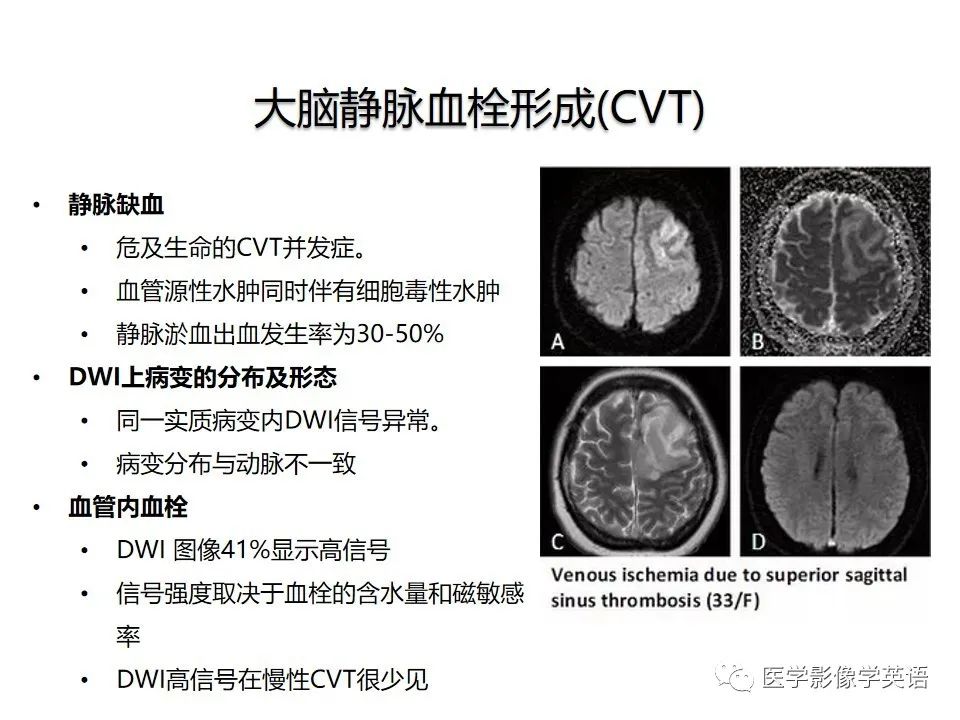 影像PPT - 【PPT】颅内DWI高信号病变：从发现病灶到准确诊断-16