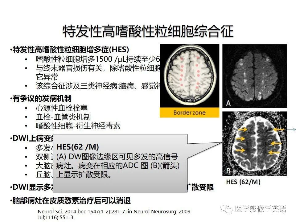 影像PPT - 【PPT】颅内DWI高信号病变：从发现病灶到准确诊断-19