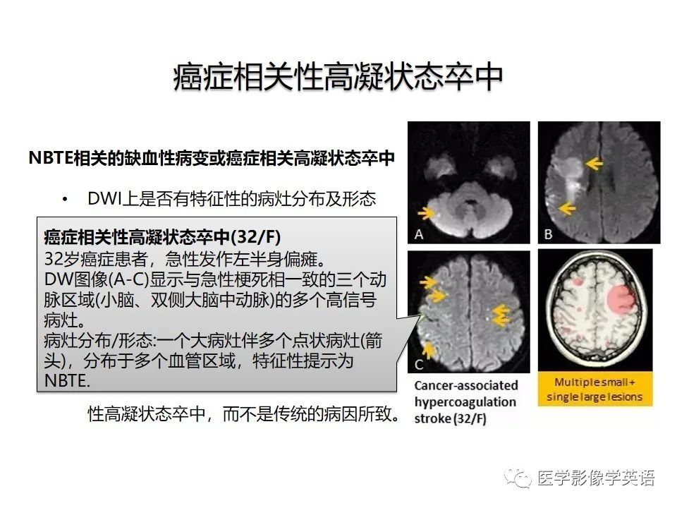 影像PPT - 【PPT】颅内DWI高信号病变：从发现病灶到准确诊断-15