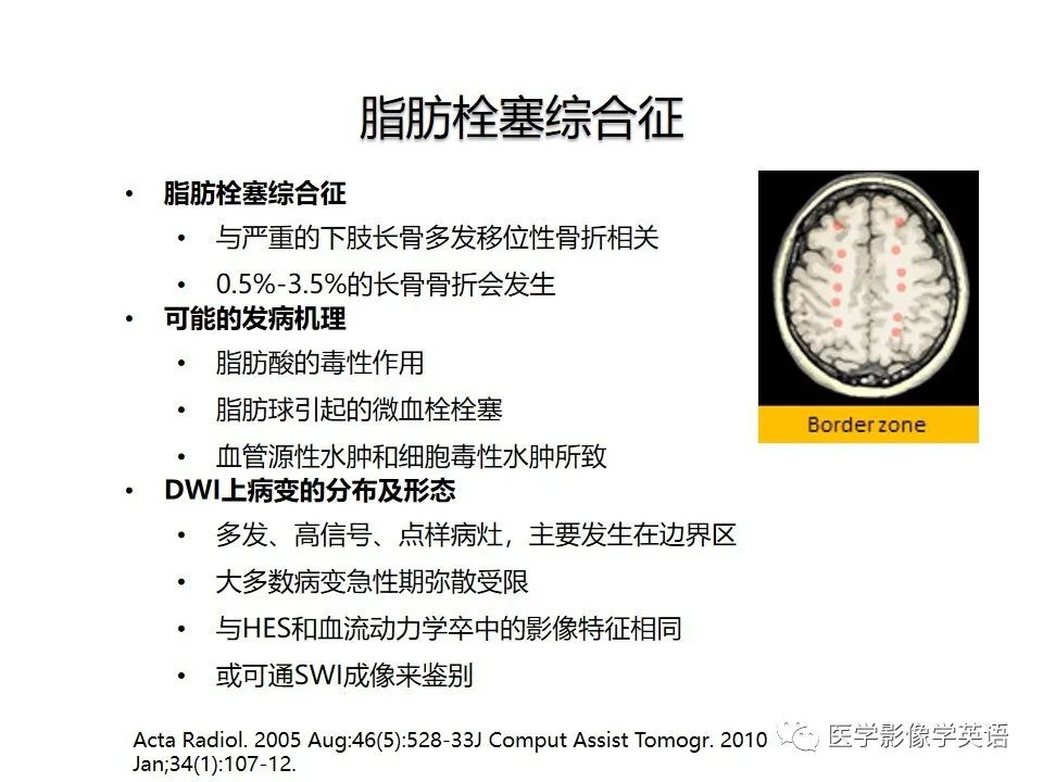 影像PPT - 【PPT】颅内DWI高信号病变：从发现病灶到准确诊断-20