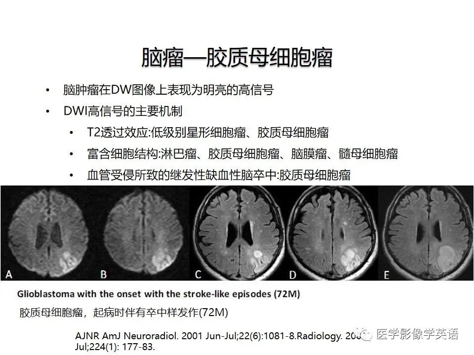 影像PPT - 【PPT】颅内DWI高信号病变：从发现病灶到准确诊断-21