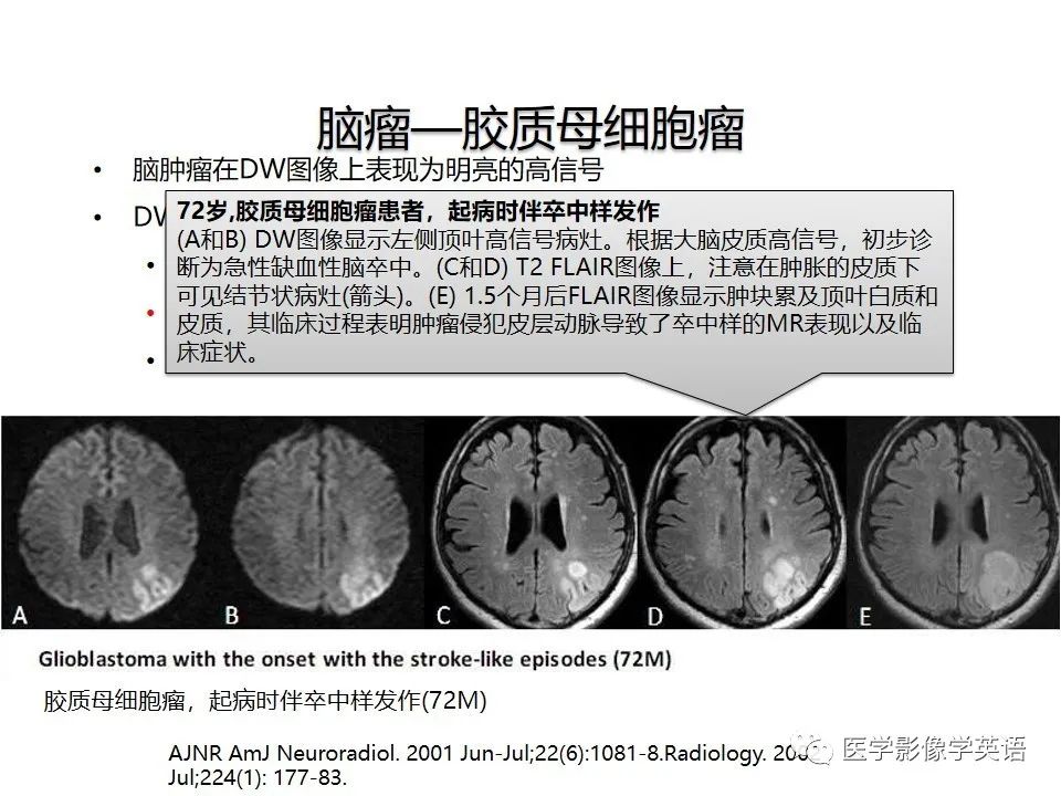 影像PPT - 【PPT】颅内DWI高信号病变：从发现病灶到准确诊断-22