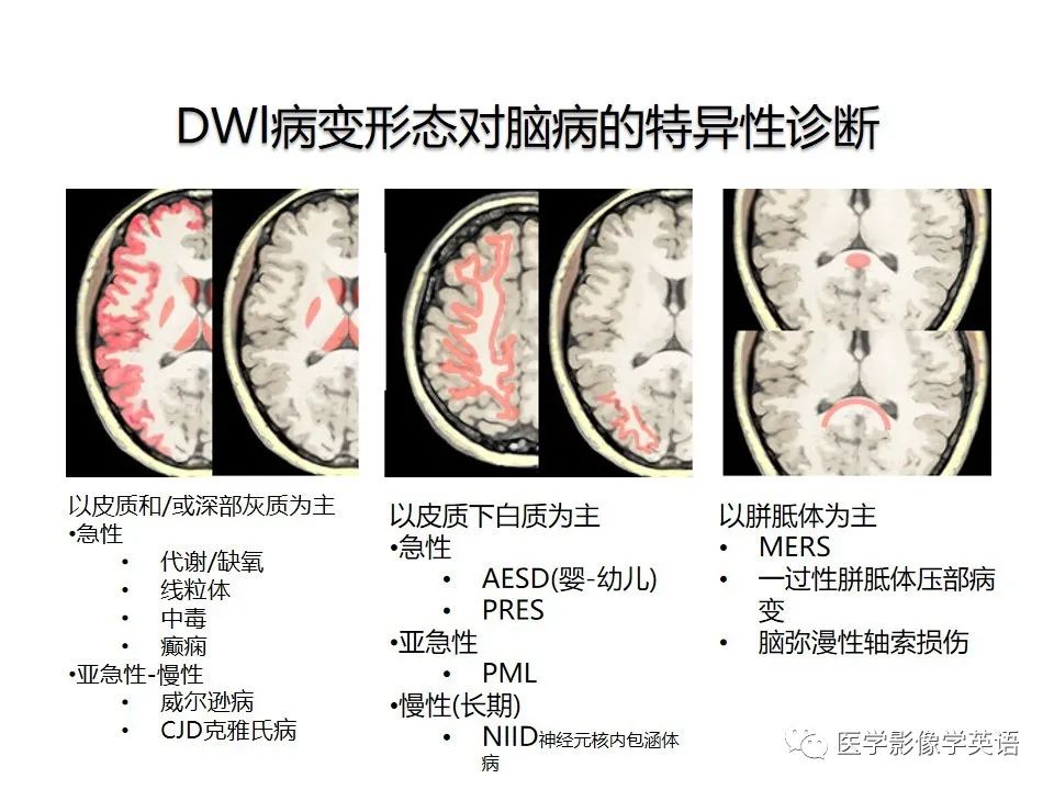 影像PPT - 【PPT】颅内DWI高信号病变：从发现病灶到准确诊断-27