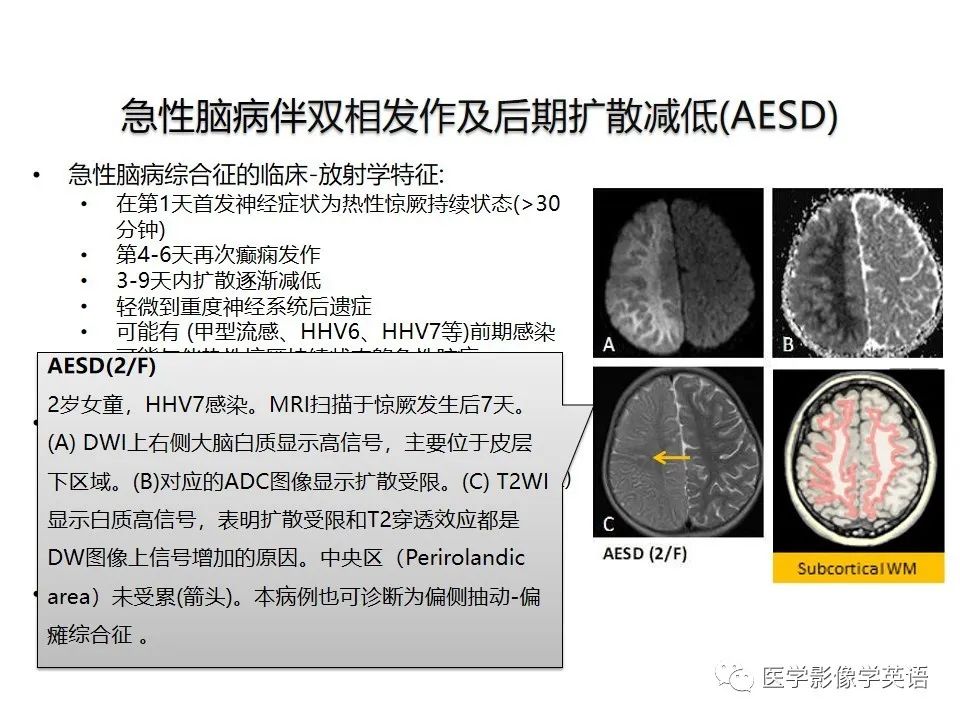 影像PPT - 【PPT】颅内DWI高信号病变：从发现病灶到准确诊断-29