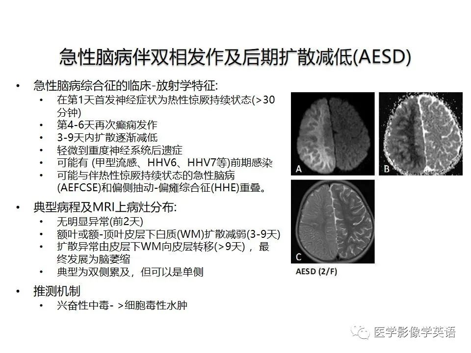 影像PPT - 【PPT】颅内DWI高信号病变：从发现病灶到准确诊断-28