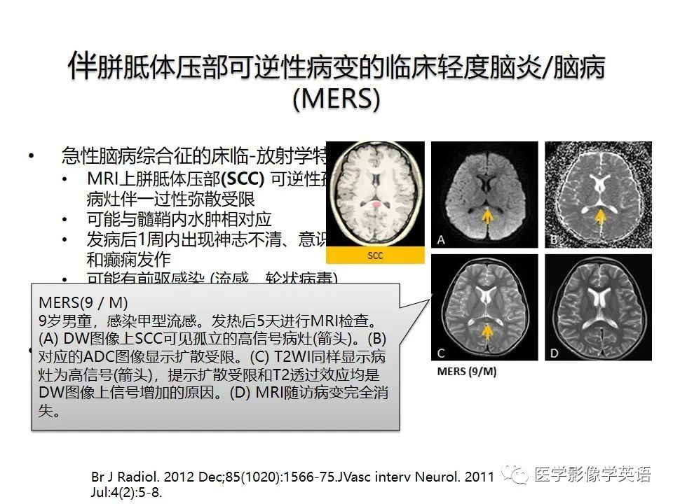 影像PPT - 【PPT】颅内DWI高信号病变：从发现病灶到准确诊断-31