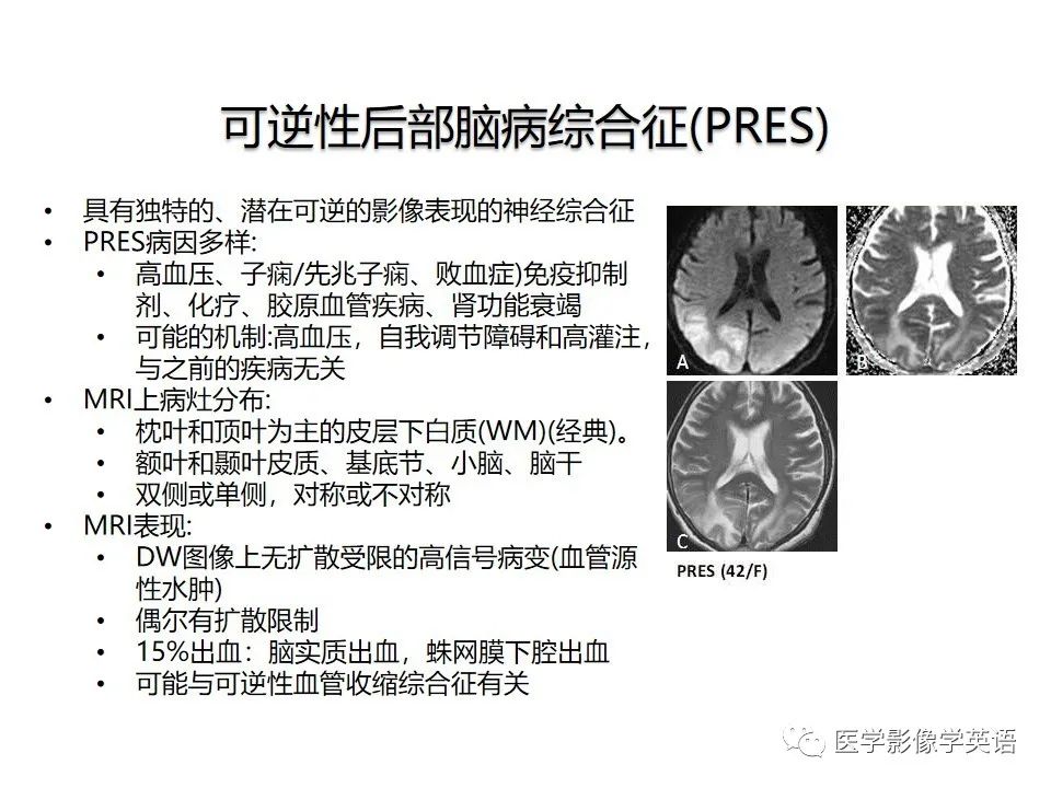 影像PPT - 【PPT】颅内DWI高信号病变：从发现病灶到准确诊断-32
