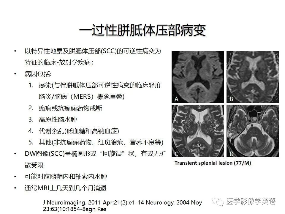影像PPT - 【PPT】颅内DWI高信号病变：从发现病灶到准确诊断-34