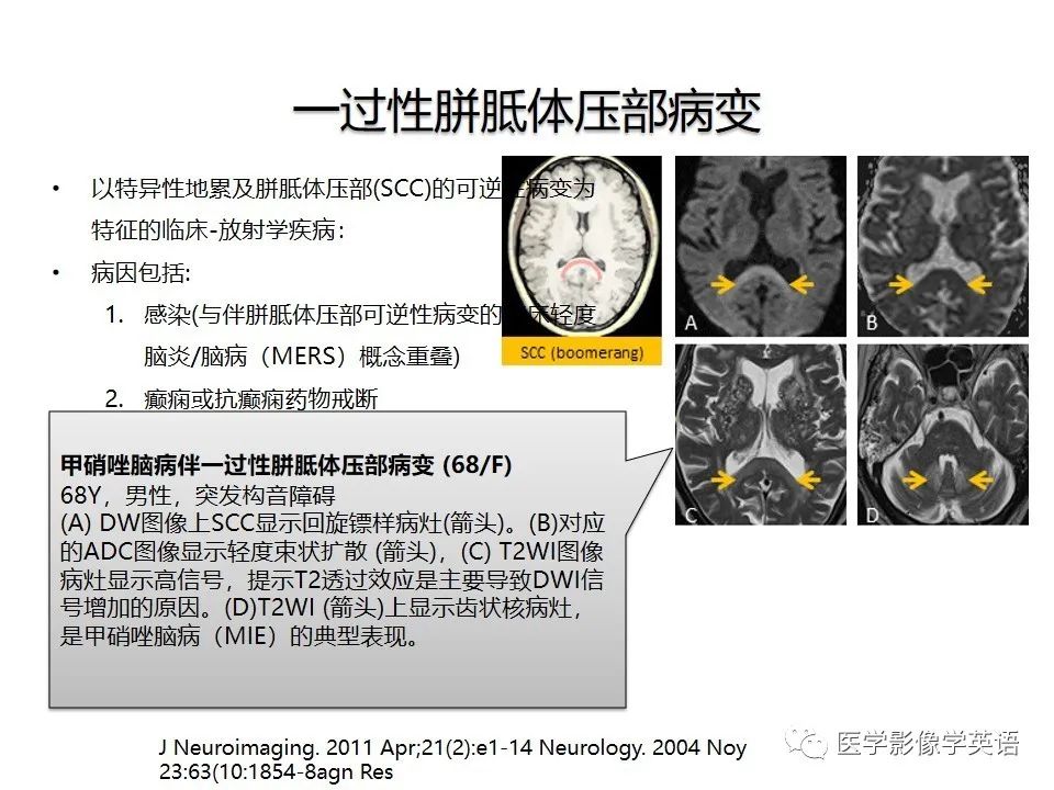 影像PPT - 【PPT】颅内DWI高信号病变：从发现病灶到准确诊断-35