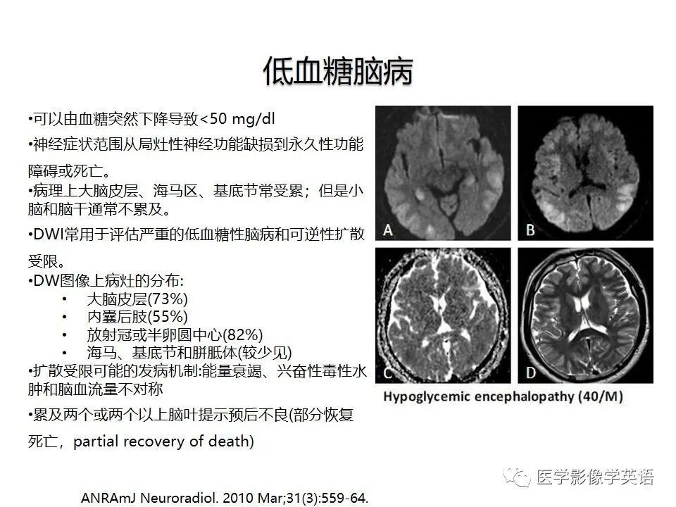 影像PPT - 【PPT】颅内DWI高信号病变：从发现病灶到准确诊断-36