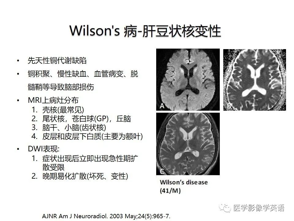 影像PPT - 【PPT】颅内DWI高信号病变：从发现病灶到准确诊断-38