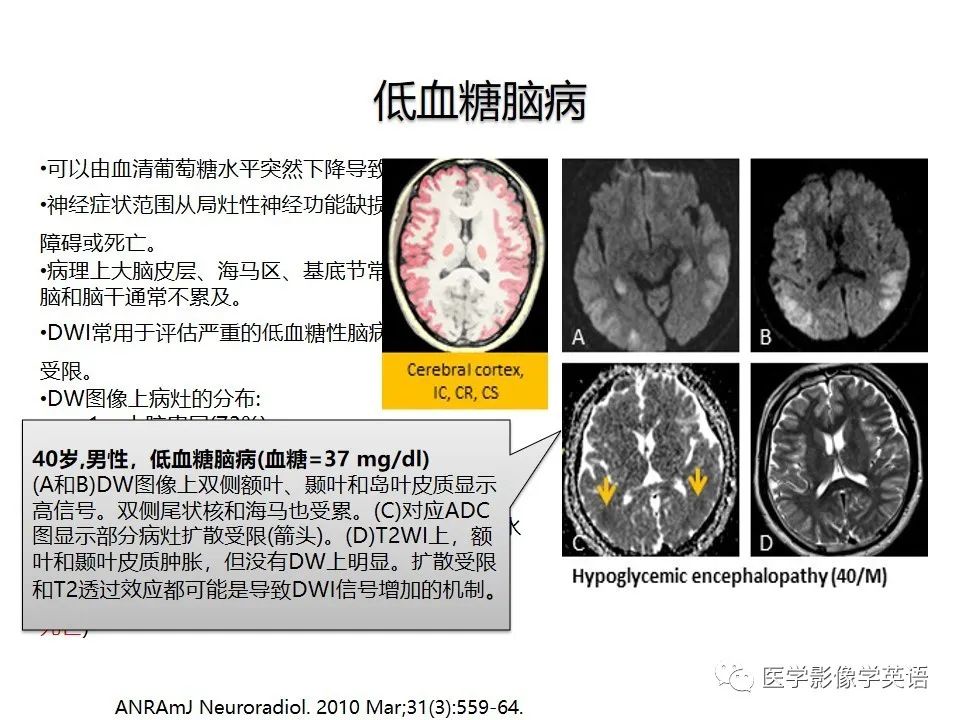 影像PPT - 【PPT】颅内DWI高信号病变：从发现病灶到准确诊断-37
