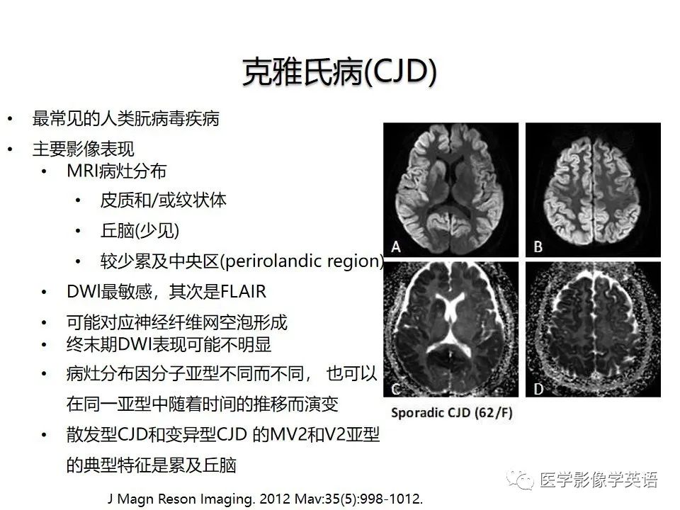 影像PPT - 【PPT】颅内DWI高信号病变：从发现病灶到准确诊断-40