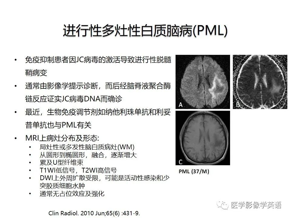 影像PPT - 【PPT】颅内DWI高信号病变：从发现病灶到准确诊断-42