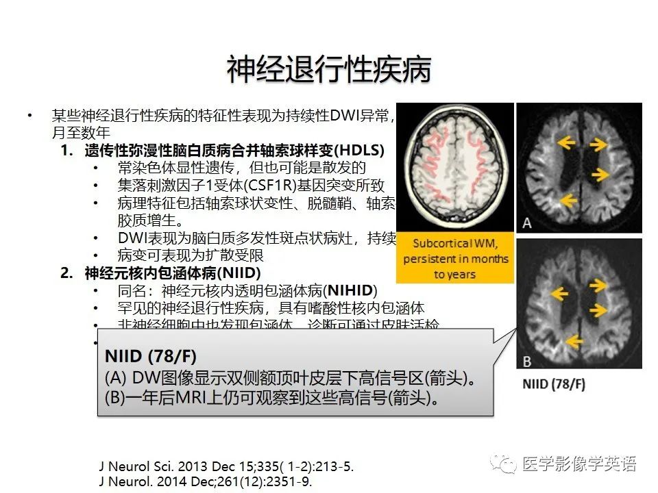 影像PPT - 【PPT】颅内DWI高信号病变：从发现病灶到准确诊断-45