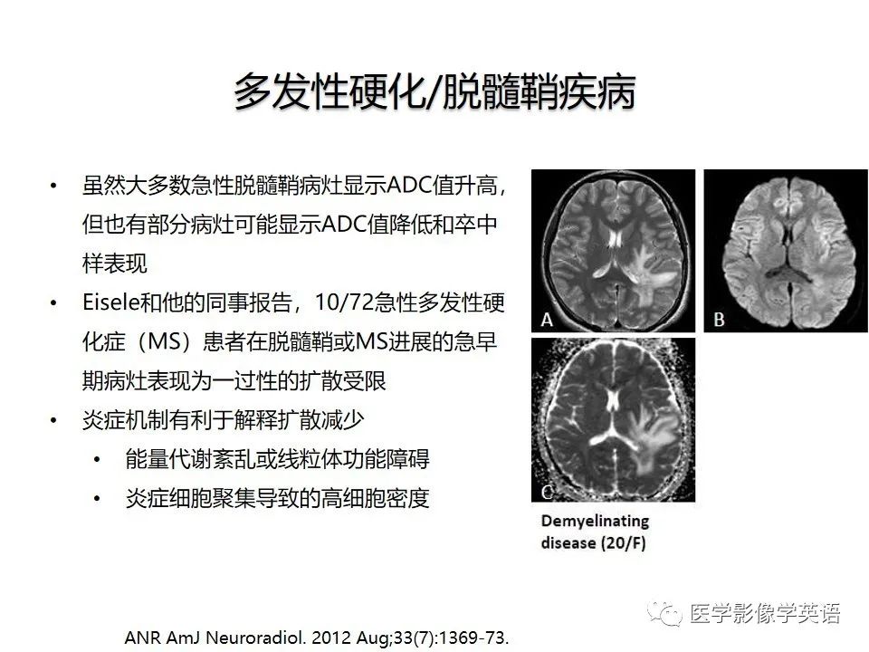 影像PPT - 【PPT】颅内DWI高信号病变：从发现病灶到准确诊断-46