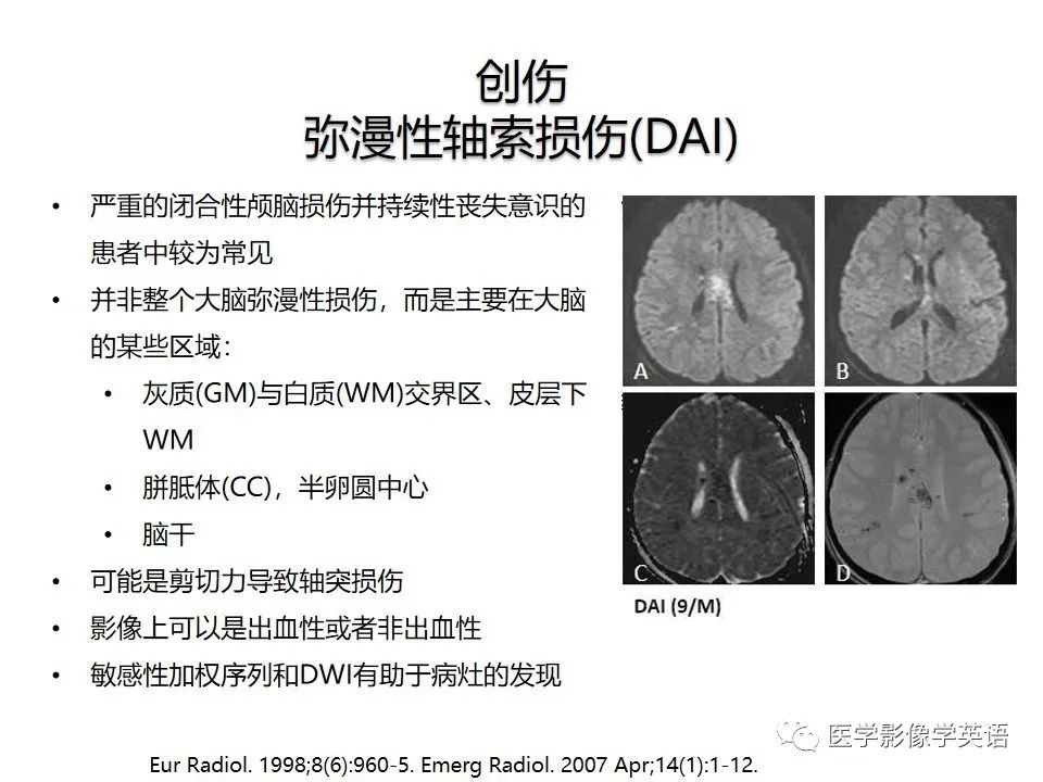 影像PPT - 【PPT】颅内DWI高信号病变：从发现病灶到准确诊断-48
