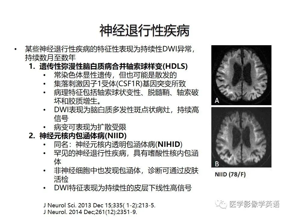 影像PPT - 【PPT】颅内DWI高信号病变：从发现病灶到准确诊断-44