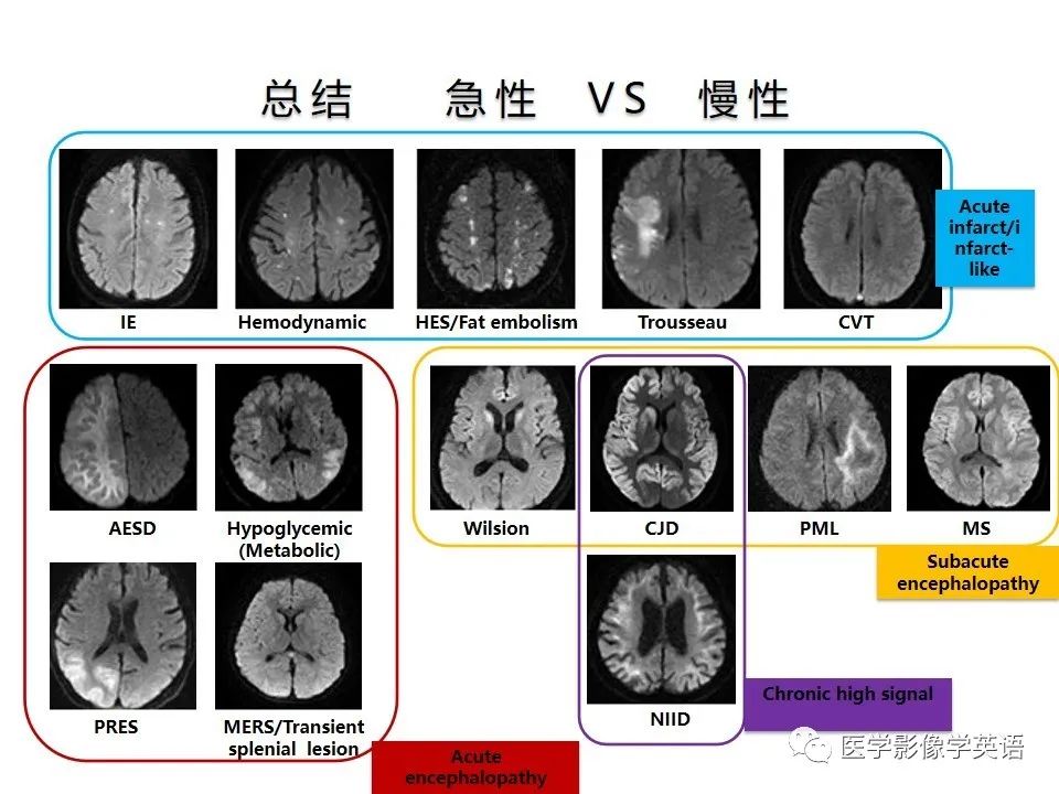 影像PPT - 【PPT】颅内DWI高信号病变：从发现病灶到准确诊断-50
