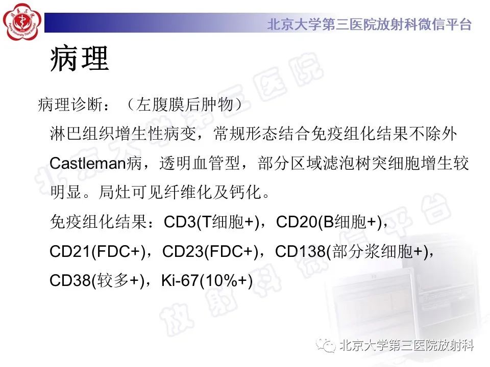 影像PPT - 【PPT】腹膜后单中心型Castleman病-9