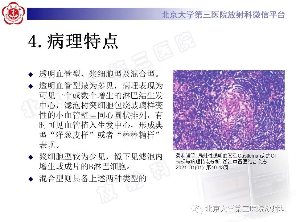 影像PPT - 【PPT】腹膜后单中心型Castleman病-14