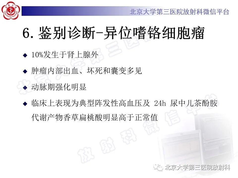 影像PPT - 【PPT】腹膜后单中心型Castleman病-16