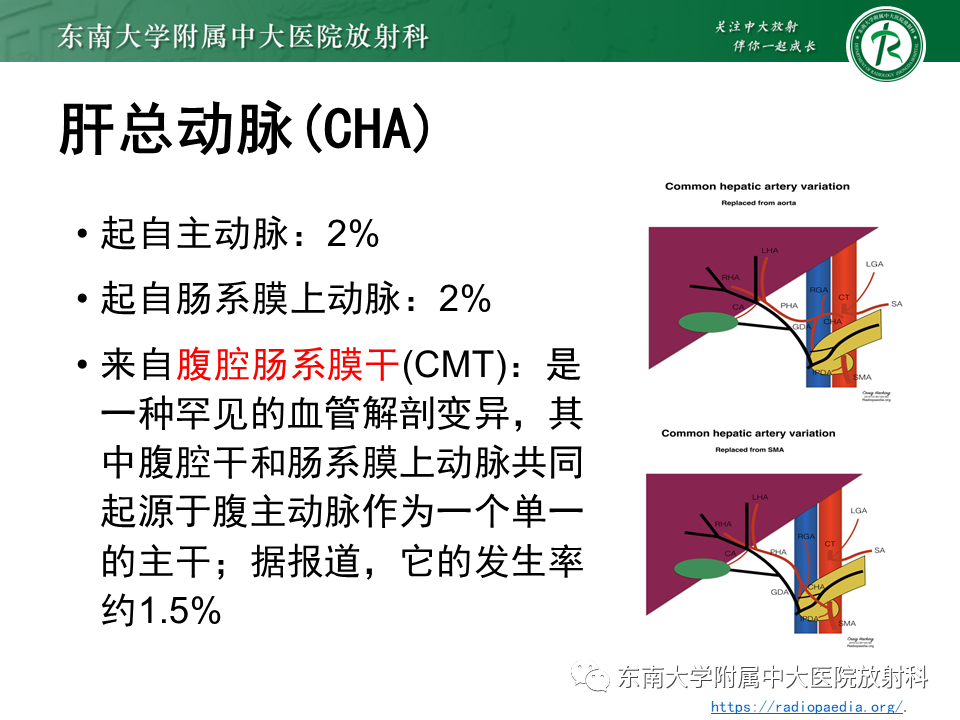 影像PPT - 【PPT】肝动脉变异-9