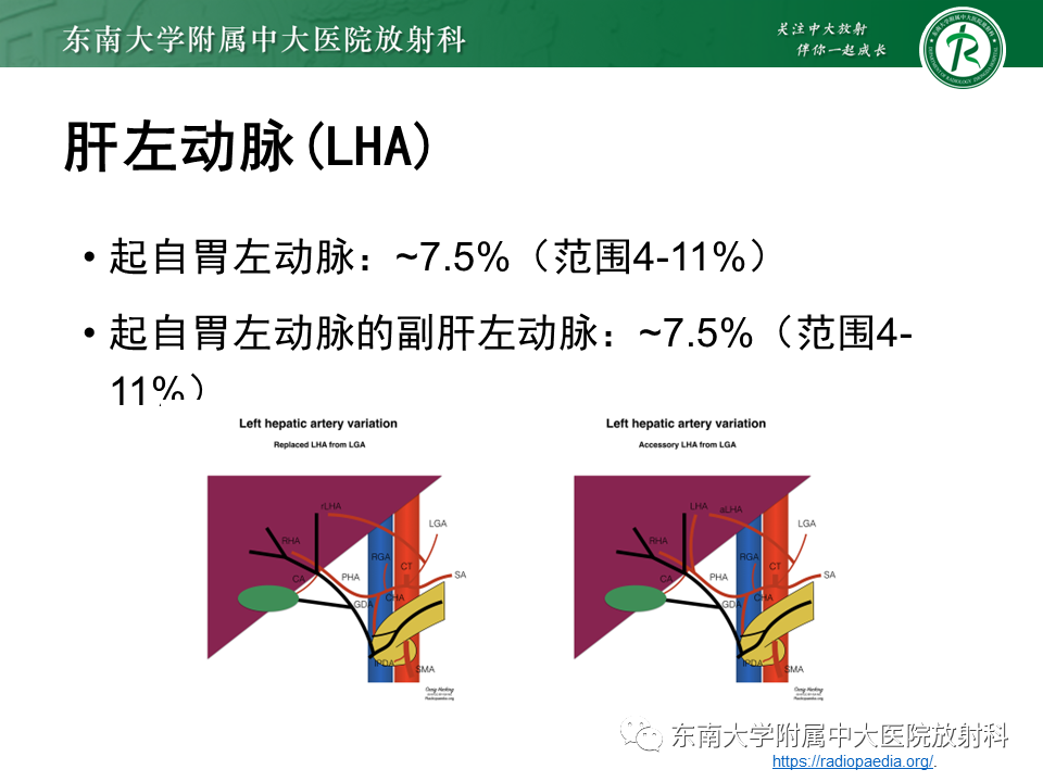 影像PPT - 【PPT】肝动脉变异-11