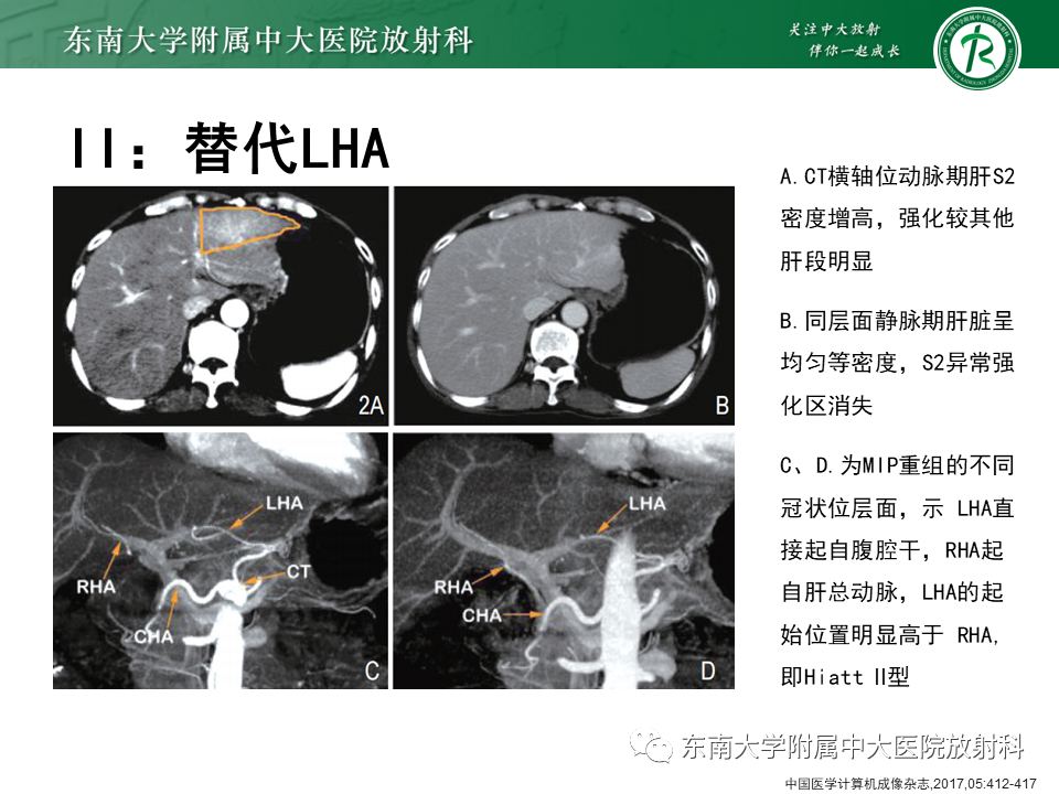 影像PPT - 【PPT】肝动脉变异-18