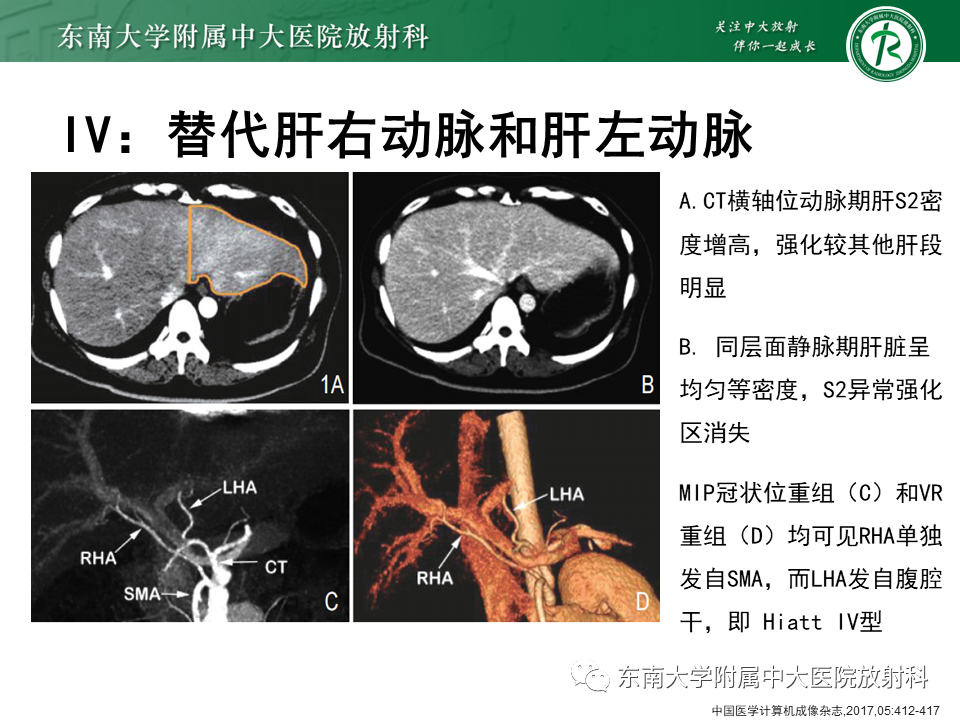 影像PPT - 【PPT】肝动脉变异-22