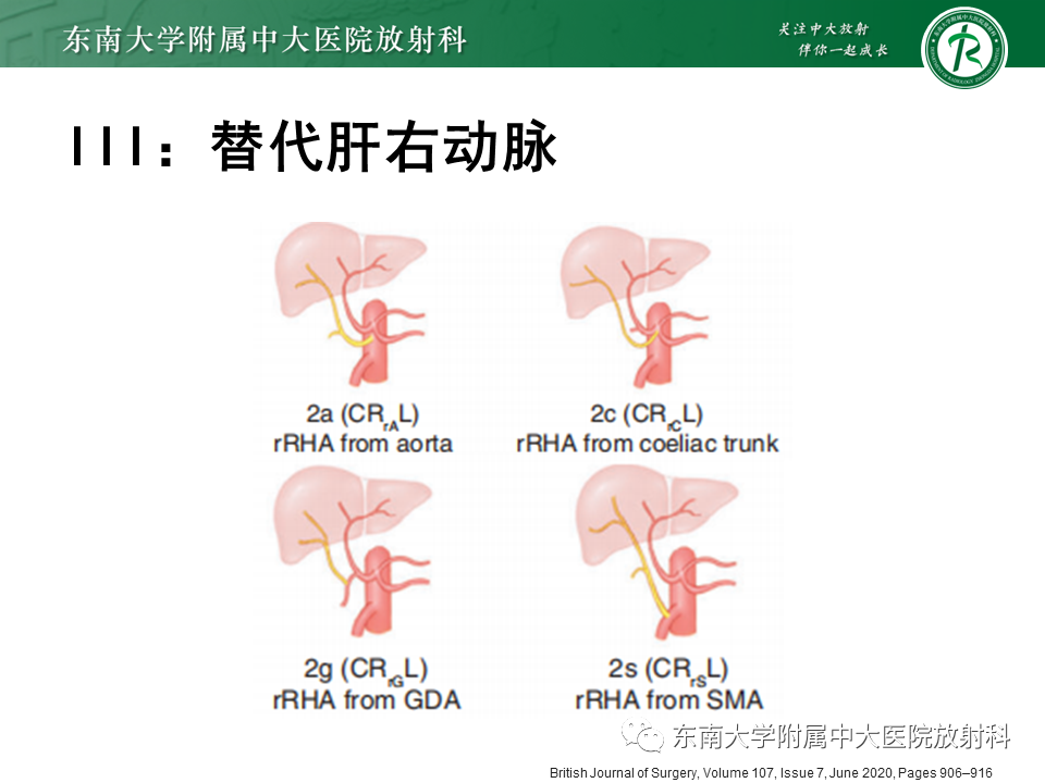 影像PPT - 【PPT】肝动脉变异-19