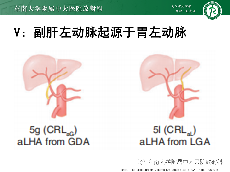 影像PPT - 【PPT】肝动脉变异-23