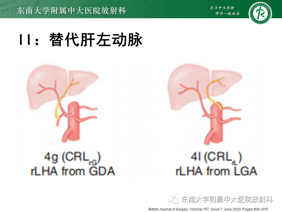 影像PPT - 【PPT】肝动脉变异-17