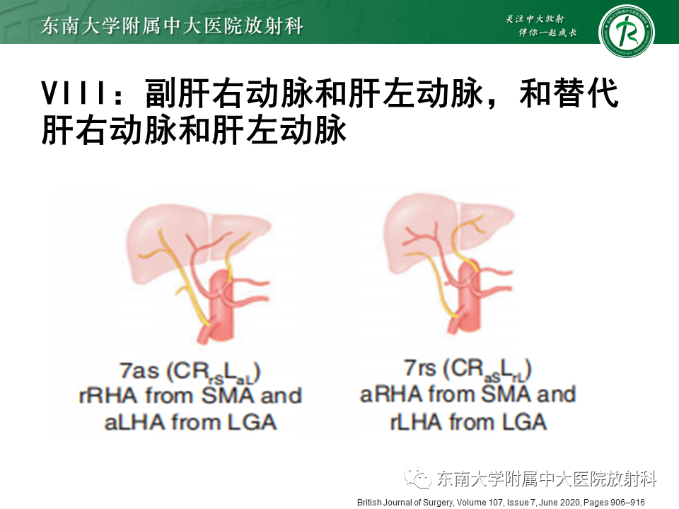 影像PPT - 【PPT】肝动脉变异-28
