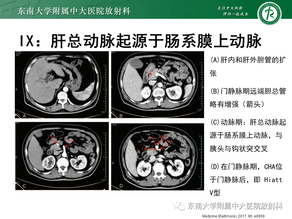 影像PPT - 【PPT】肝动脉变异-31