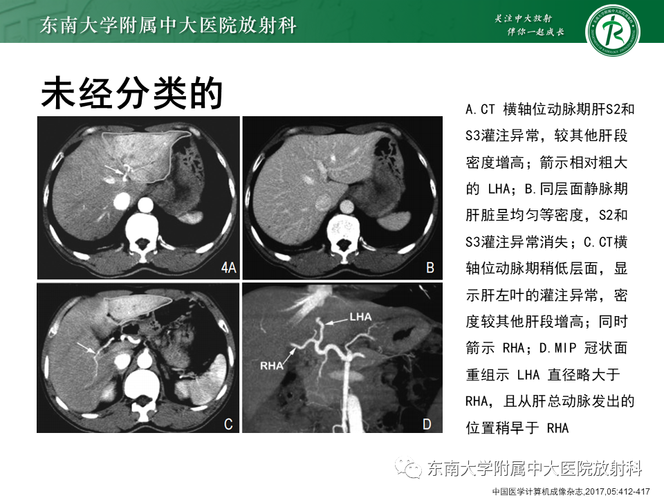 影像PPT - 【PPT】肝动脉变异-37